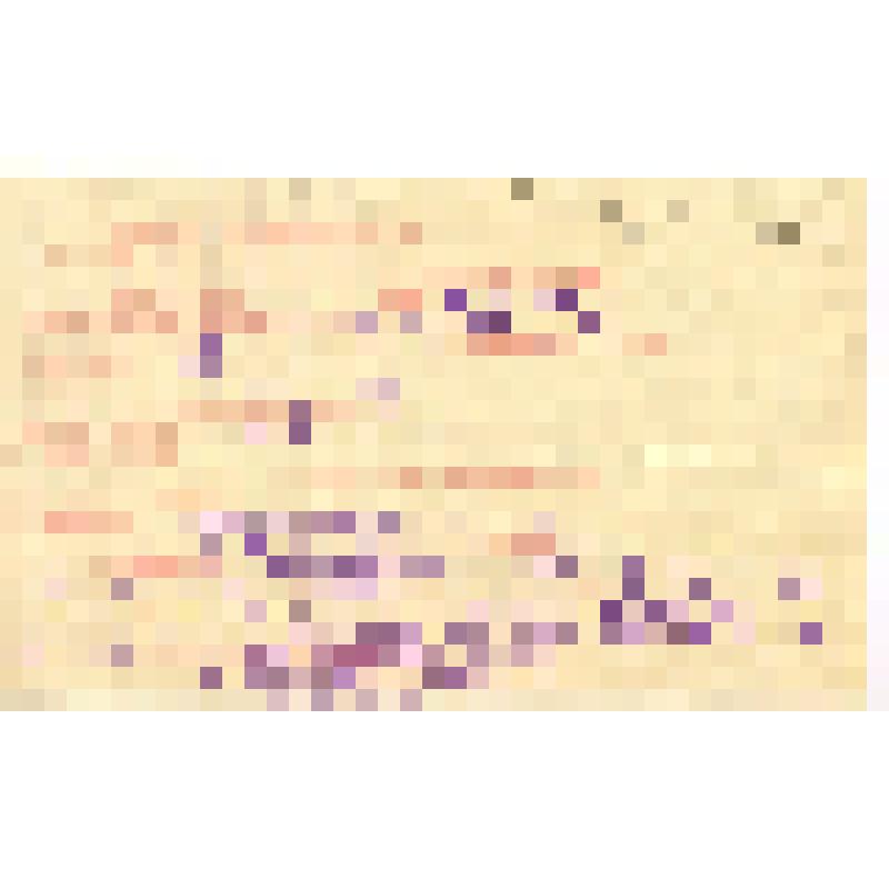 Выписка из постановления врачебной комиссии при поликлинике ст. Белово Казакова Павла Петровича