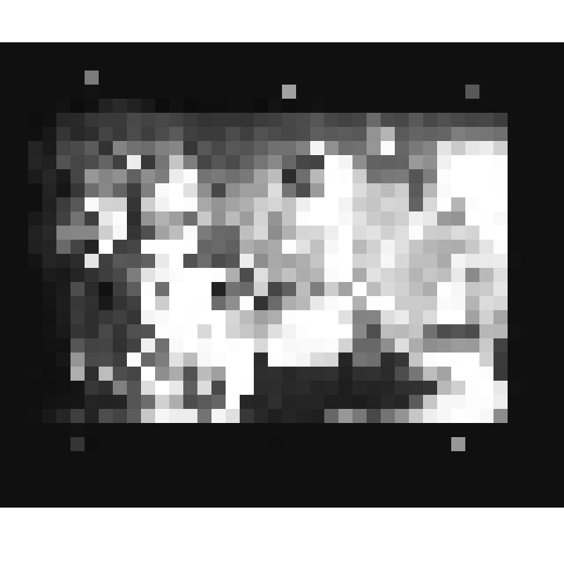 В медсанбате 9-ой Гвардейской дивизии -операционная. Слева на переднем плане военный врач Смоленская И.А., справа: медсестра Сусанна Смоленская, в центре военврач Бридихина О.И. Операция руки у лейтенанта Рудько А.И