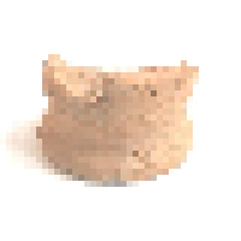 Придонная часть сосуда