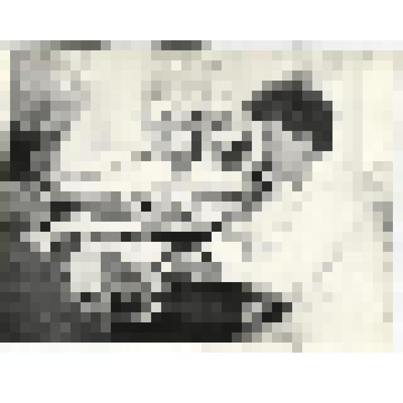 Заведующая отделением глазной хирургии Тюменской областной больницы Л.В. Табанакова. Фотография чёрно-белая