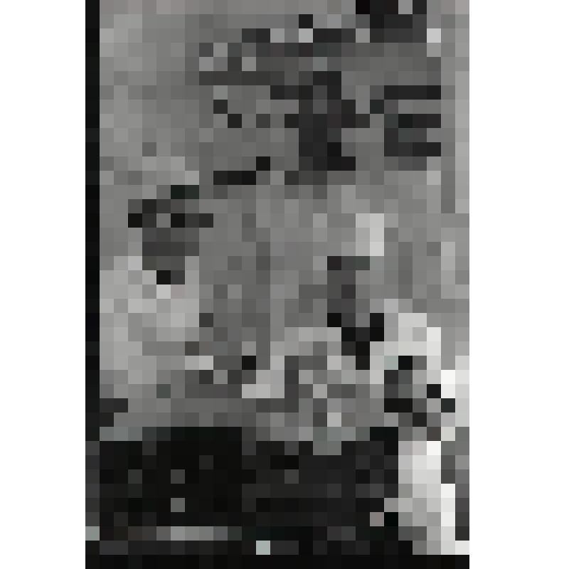 Негатив. Челябинская горбольница №1. Отделение эндоскопии. Применение волоконной оптики для исследования и лечения