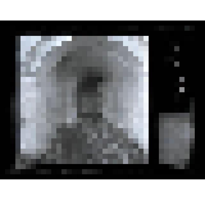 Негатив. Церковь Вознесения Господня. Галерея. Коломенское