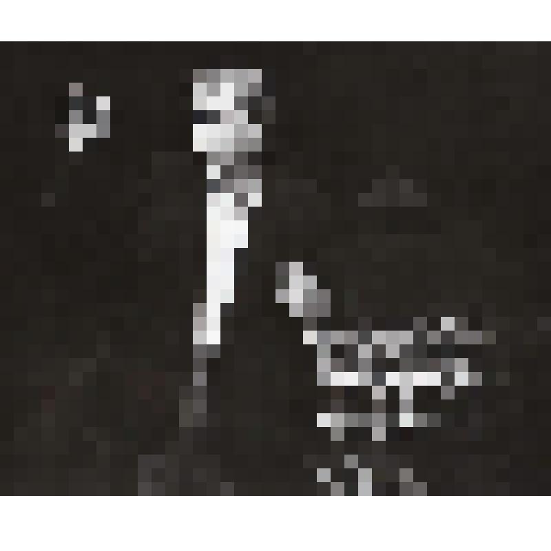 Фотография. Вильнюс, А. Латенас, поколенно, фас, с забинтованными пальцами на руках, одна рука поднята вверх. "Песни тоски по отчизне" (пост. Д. Тамулявичуте, худ. А. Яцовскис)