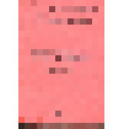 Книга. Ошибки и осложнения диагностики и лечения в острой абдоминальной и сосудистой хирургии. - Иркутск, 1983