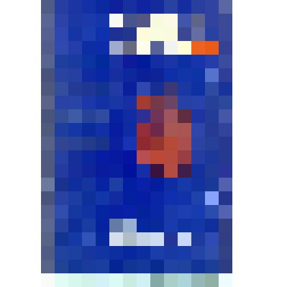 Брошюра. Клинические варианты хронического ишемического синдрома нижних конечностей. - Москва, 1980. - Отдельный оттиск