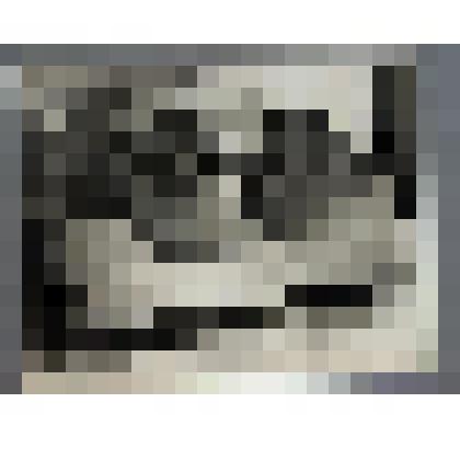 Гипсовый глаз