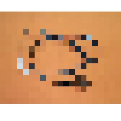 Фонендоскоп