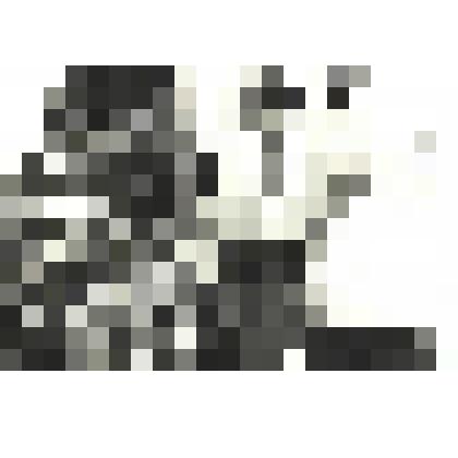 Фотографии. Фото ч/б. Врач Идт В.В. осматривает ногу женщины 80-ые годы XX века